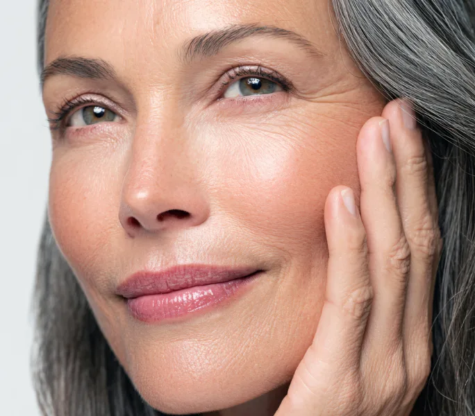 Microneedling at Avelure Med Spa